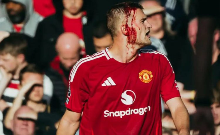 مصدومیت ترسناک و خونین در الدترافورد (عکس)