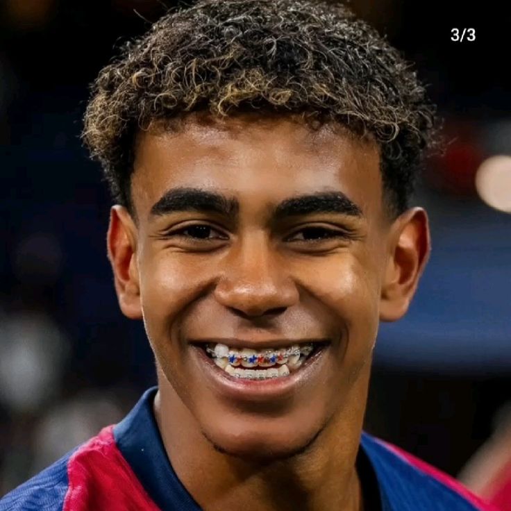 ارتودنسیهای لامین یامال